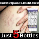 Gentle Skin Care Improves Elasticity Effective After Pregnancy Stretch Marks Removal Powerful Maternity Cream Nourishes Skin - Imagine 6