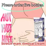 Gentle Skin Care Improves Elasticity Effective After Pregnancy Stretch Marks Removal Powerful Maternity Cream Nourishes Skin - Imagine 4