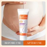 Stretch Marks Removal Cream Light Lines Postpartum Obesity Pregnancy Powerful Fast Absorption - Imagine 5